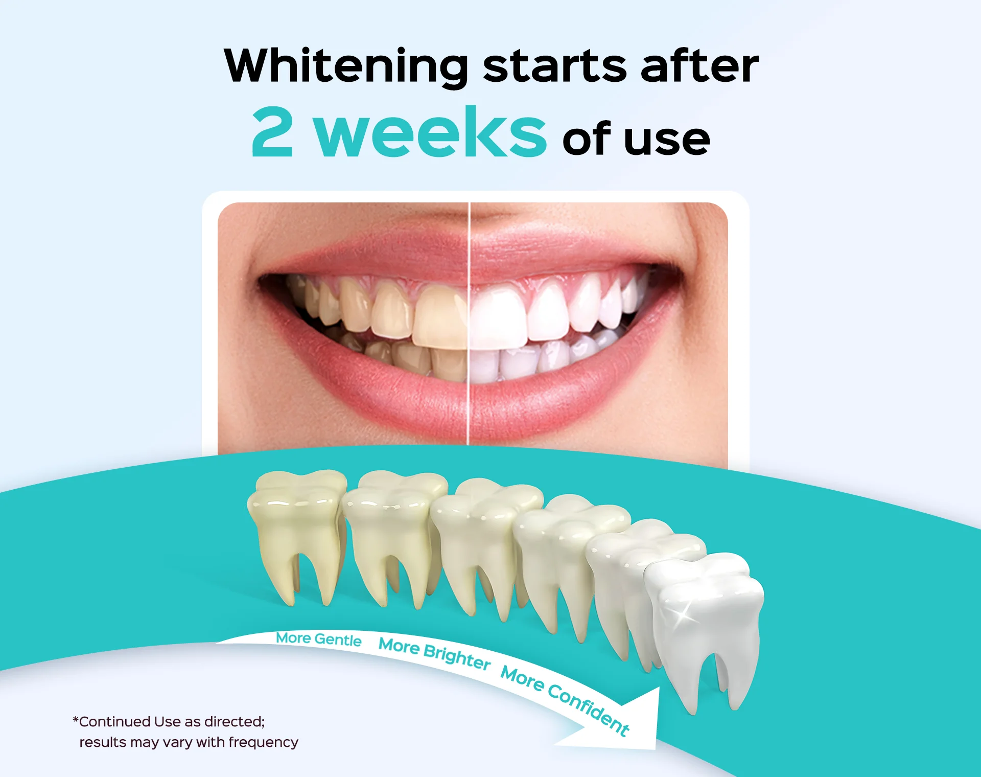 COSLUS W40 Whitening Water Flosser - Image 3